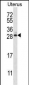 ARL8A Antibody (Center)